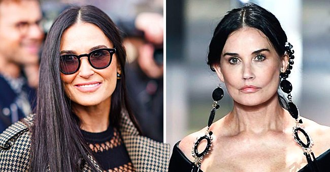 Sculptra : Le Secret Anti-Âge des Stars Américaines